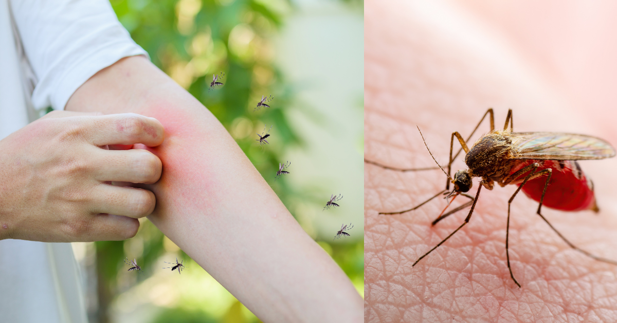Dengue Infection: Prevention, Diagnosis & Trustworthy Testing Solutions