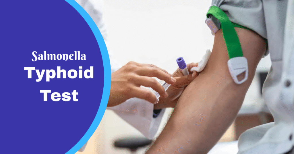 Salmonella Typhi Blog Banner