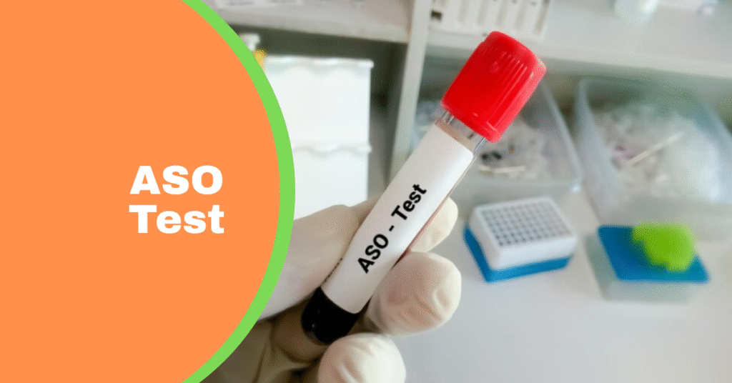 ASO Blog Banner