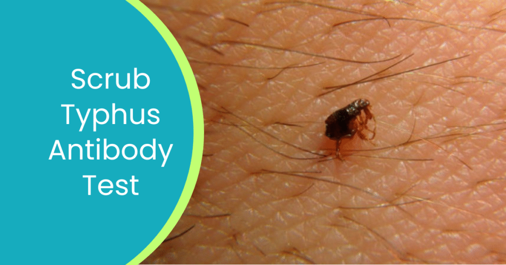Scrub Typhus Ab Test Blog image