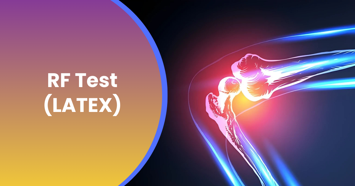 Understanding the RF Test: Rapid Detection of Rheumatoid Factor