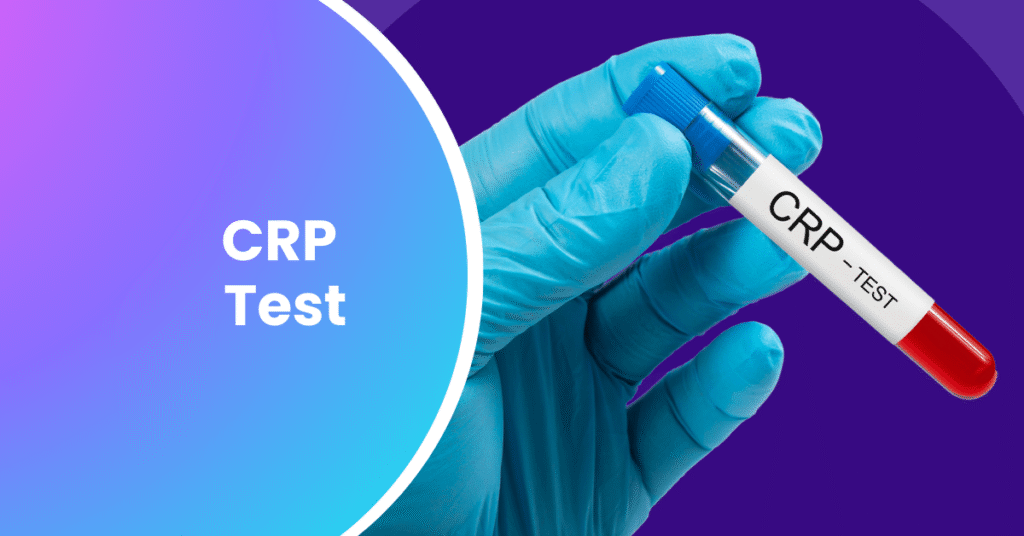 CRP test Blog image