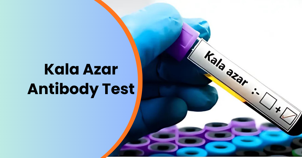 Kala Azar Diagnosis Made Easy with Antibody Test