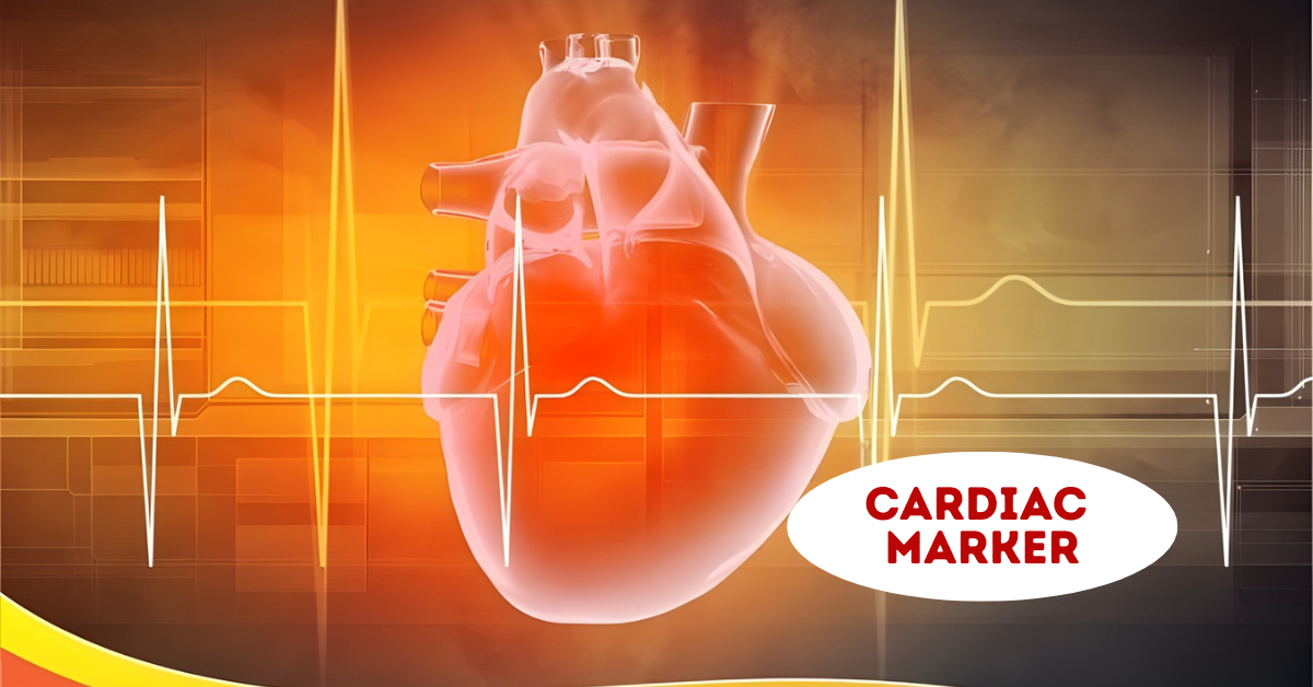 Cardiac Markers: Early Detection, Accurate Diagnosis & Save Lives