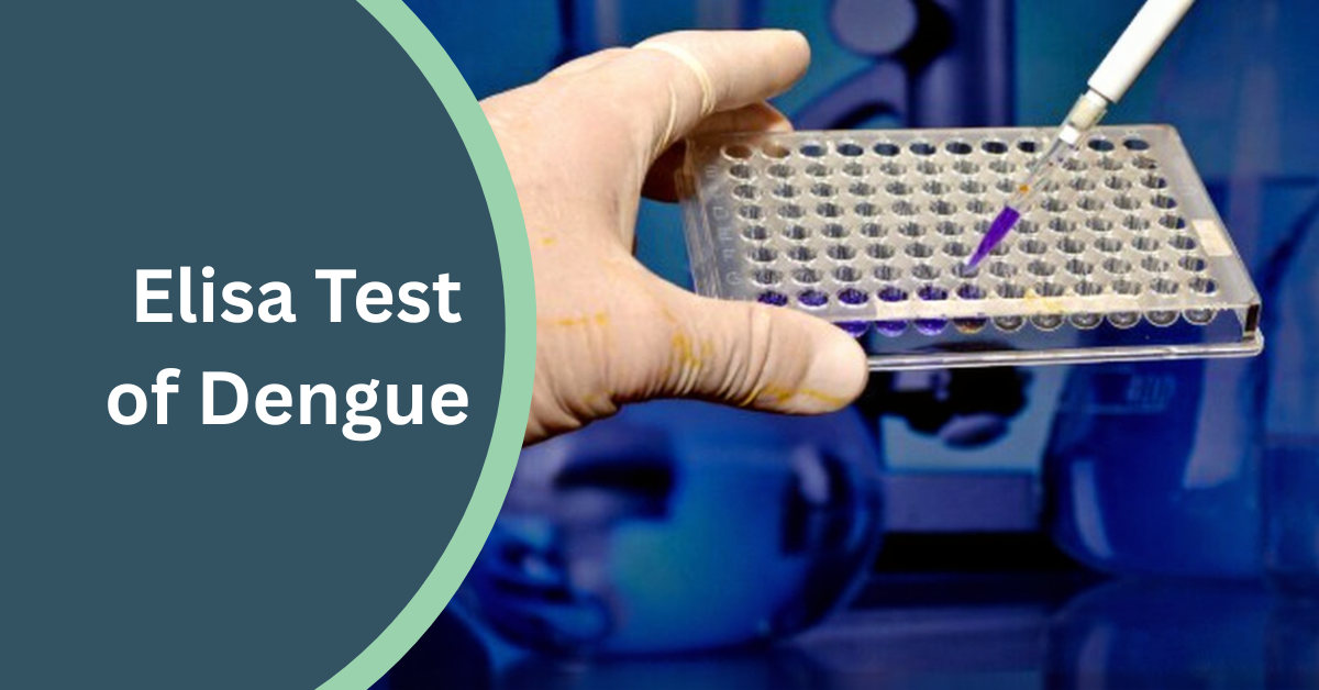 Dengue ELISA: Diagnostic Tool for Dengue Fever in Winter