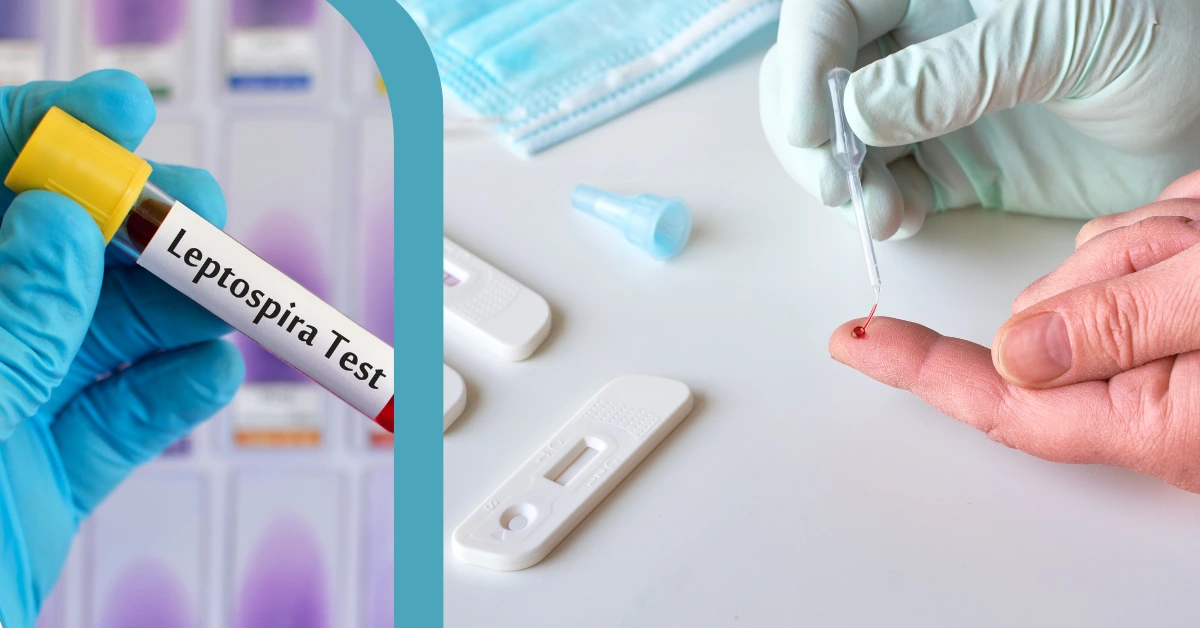 Leptospira Test: A Rapid Test Kit Tool for Detection & Prevention