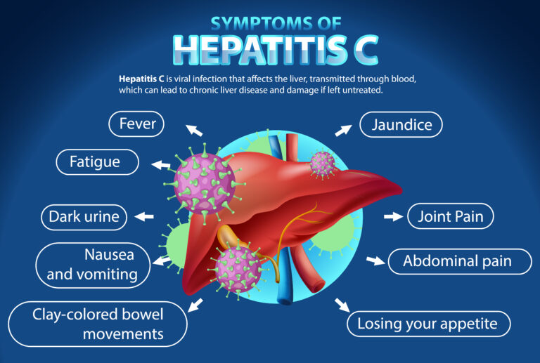 Symptoms of Hepatitis C