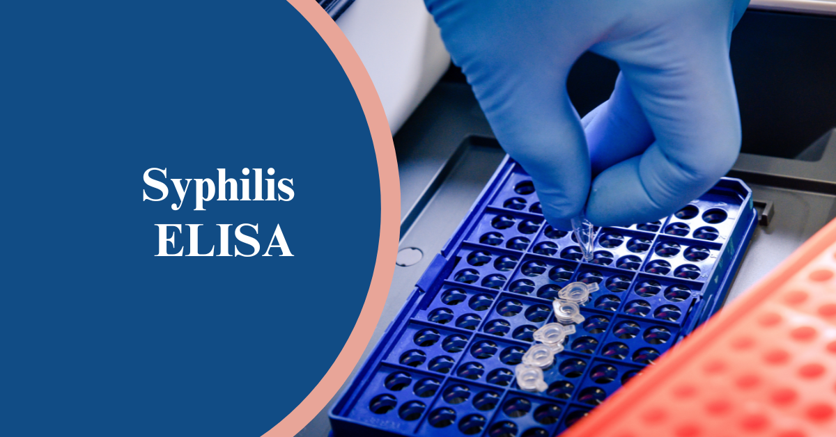 Syphilis Diagnosis: TP ELISA Test for Accurate Diagnosis